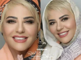 تغییر چهره شگفت‌ انگیز رابعه اسکویی