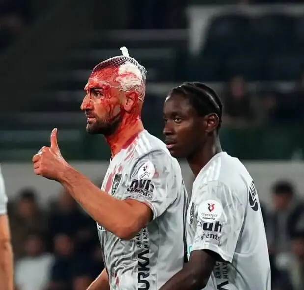 سردار دورسون، مهاجم سابق پرسپولیس در ترکیه غرق در خون شد! +عکس