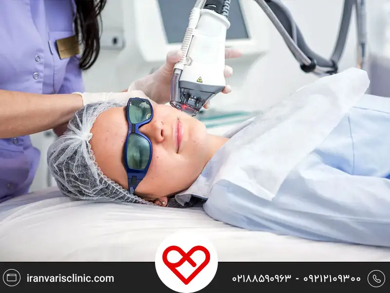 بهترین روشهای درمان واریس صورت بدون جراحی